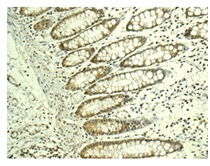Immunohistochemistry (Formalin/PFA-fixed paraffin-embedded sections) - Anti-MAGP2 antibody [EPCSUR1] (AB171737), expandable thumbnail