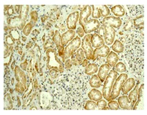 Immunohistochemistry (Formalin/PFA-fixed paraffin-embedded sections) - Anti-MAGP2 antibody [EPCSUR1] - BSA and Azide free (AB249642)