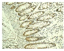 Immunohistochemistry (Formalin/PFA-fixed paraffin-embedded sections) - Anti-MAGP2 antibody [EPCSUR1] - BSA and Azide free (AB249642)