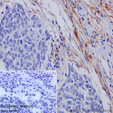 Immunohistochemistry (Formalin/PFA-fixed paraffin-embedded sections) - Anti-MAGP2 antibody [EPR17581] (AB203828), expandable thumbnail