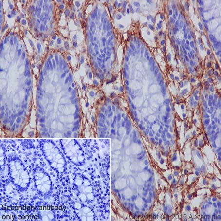 Immunohistochemistry (Formalin/PFA-fixed paraffin-embedded sections) - Anti-MAGP2 antibody [EPR17581] (AB203828), expandable thumbnail