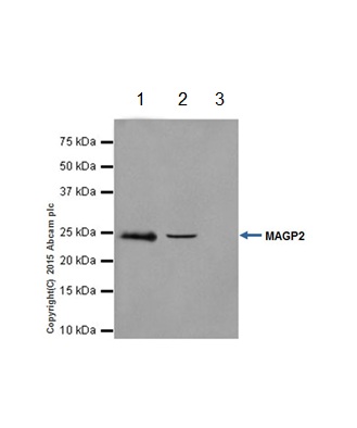 Immunoprecipitation - Anti-MAGP2 antibody [EPR17581] (ab203828), expandable thumbnail