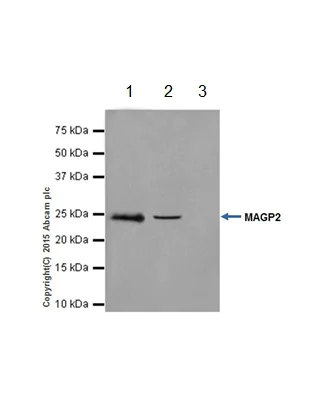 Immunoprecipitation - Anti-MAGP2 antibody [EPR17581] (AB203828)