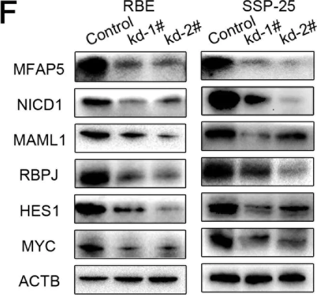 Western blot - Anti-MAGP2 antibody [EPR17581] (AB203828)