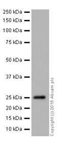Western blot - Anti-MAGP2 antibody [EPR17581] (AB203828), expandable thumbnail