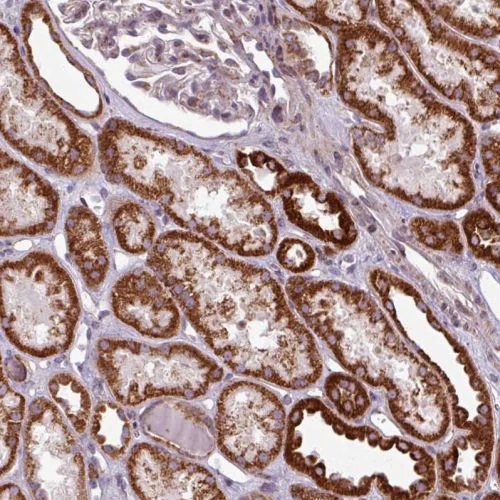 Immunohistochemistry (Formalin/PFA-fixed paraffin-embedded sections) - Anti-MAGT1 antibody (AB244490)