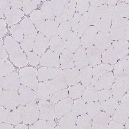 Immunohistochemistry (Formalin/PFA-fixed paraffin-embedded sections) - Anti-MAGT1 antibody (AB244490)