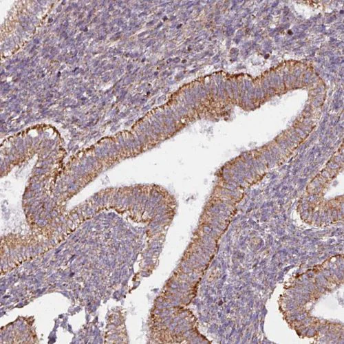 Immunohistochemistry (Formalin/PFA-fixed paraffin-embedded sections) - Anti-MAGT1 antibody (AB244490)