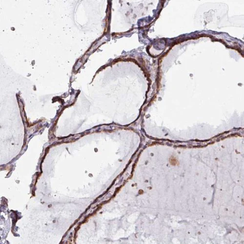 Immunohistochemistry (Formalin/PFA-fixed paraffin-embedded sections) - Anti-MAGT1 antibody (AB244490)