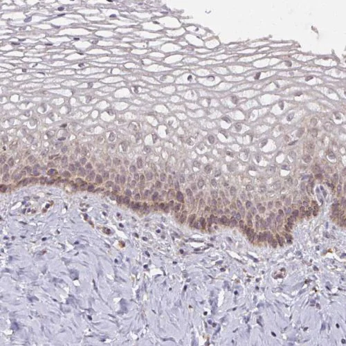 Immunohistochemistry (Formalin/PFA-fixed paraffin-embedded sections) - Anti-MAGT1 antibody (AB244490)