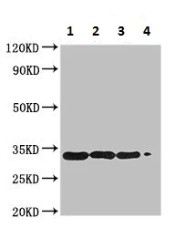 Western blot - Anti-Major pollen allergen Bet v 1-A protein antibody (AB225687)
