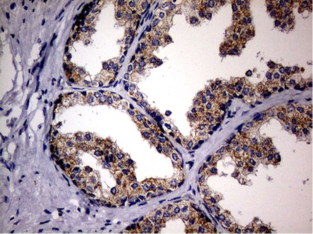 Immunohistochemistry (Formalin/PFA-fixed paraffin-embedded sections) - Anti-MAK antibody [OTI1G2] (AB279383), expandable thumbnail