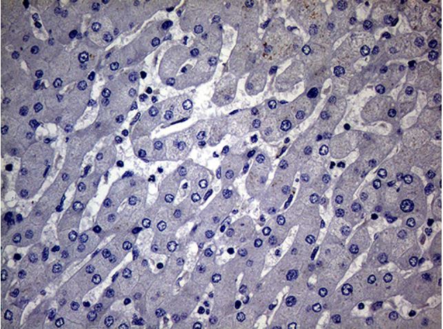 Immunohistochemistry (Formalin/PFA-fixed paraffin-embedded sections) - Anti-MAK antibody [OTI1G2] (AB279383), expandable thumbnail