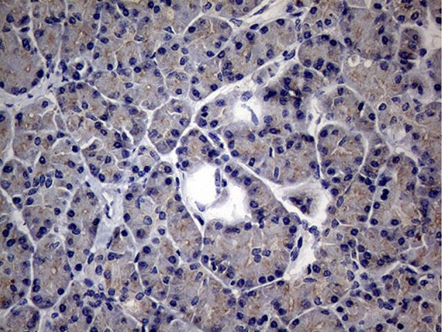 Immunohistochemistry (Formalin/PFA-fixed paraffin-embedded sections) - Anti-MAK antibody [OTI1G2] (AB279383), expandable thumbnail