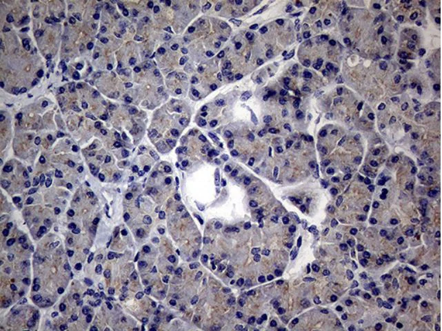 Immunohistochemistry (Formalin/PFA-fixed paraffin-embedded sections) - Anti-MAK antibody [OTI1G2] (AB279383)