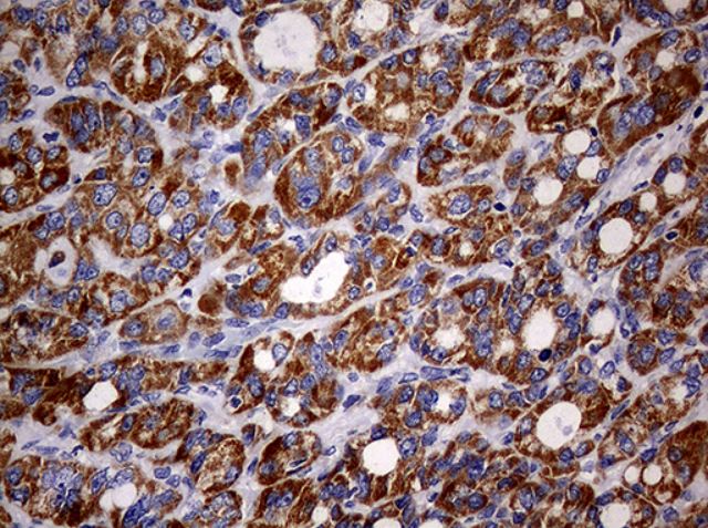 Immunohistochemistry (Formalin/PFA-fixed paraffin-embedded sections) - Anti-MAK antibody [OTI1G2] (AB279383), expandable thumbnail