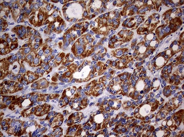 Immunohistochemistry (Formalin/PFA-fixed paraffin-embedded sections) - Anti-MAK antibody [OTI1G2] (AB279383)