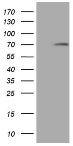 Western blot - Anti-MAK antibody [OTI1G2] (ab279383), expandable thumbnail