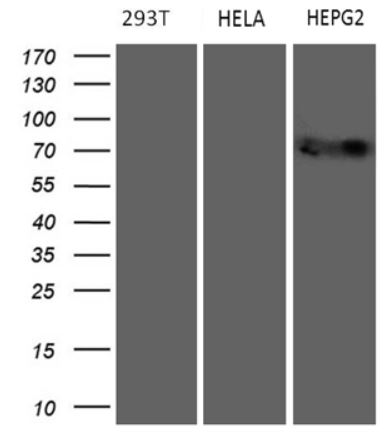 Western blot - Anti-MAK antibody [OTI1G2] (AB279383), expandable thumbnail