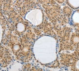 Immunohistochemistry (Formalin/PFA-fixed paraffin-embedded sections) - Anti-mAKAP antibody (AB199104), expandable thumbnail