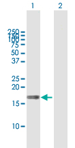 Western blot - Anti-MAL antibody (AB167374)