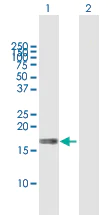 Western blot - Anti-MAL antibody (AB167374)