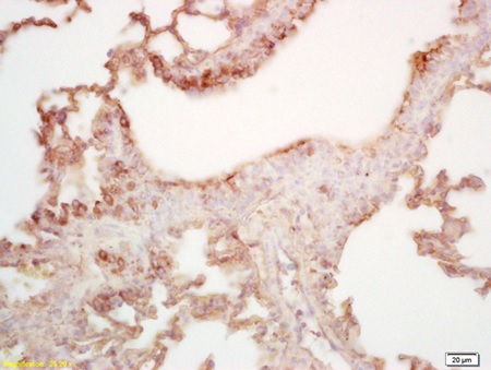 Immunohistochemistry (Formalin/PFA-fixed paraffin-embedded sections) - Anti-MAL2 antibody (AB217919), expandable thumbnail