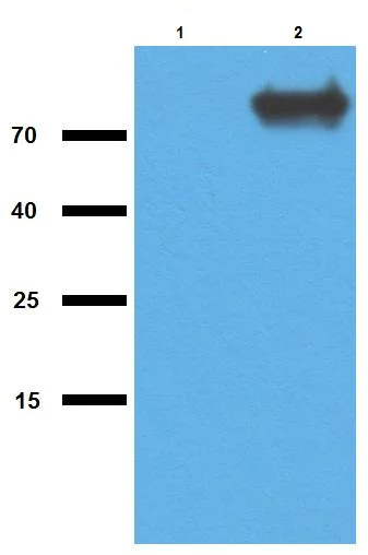 Western blot - Anti-Malate synthase G antibody (AB231199)