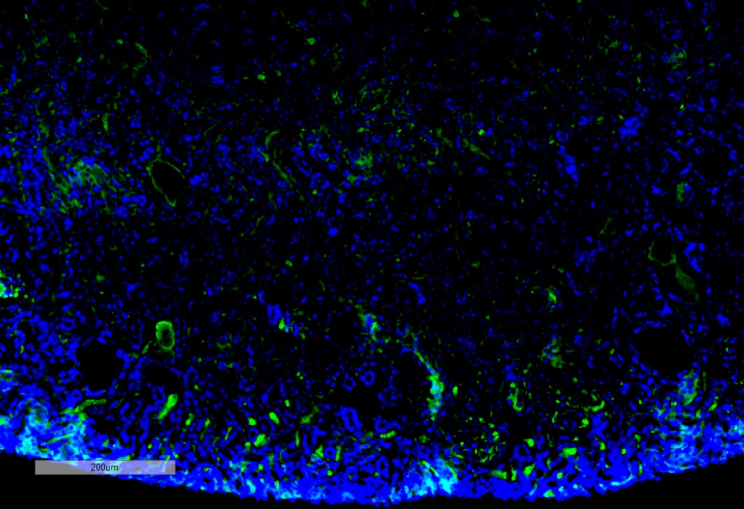 Immunohistochemistry (Formalin/PFA-fixed paraffin-embedded sections) - Anti-Malondialdehyde antibody [11E3] (AB243066)