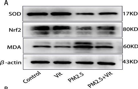 Western blot - Anti-Malondialdehyde antibody (AB27642)