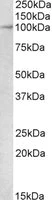 Western blot - Anti-MALT1/MLT antibody (AB118393)