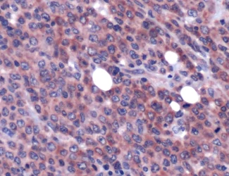 Immunohistochemistry (Formalin/PFA-fixed paraffin-embedded sections) - Anti-MALT1/MLT antibody (AB93661)