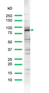 Western blot - Anti-MALT1/MLT antibody (AB93661), expandable thumbnail