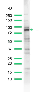 Western blot - Anti-MALT1/MLT antibody (AB93661)