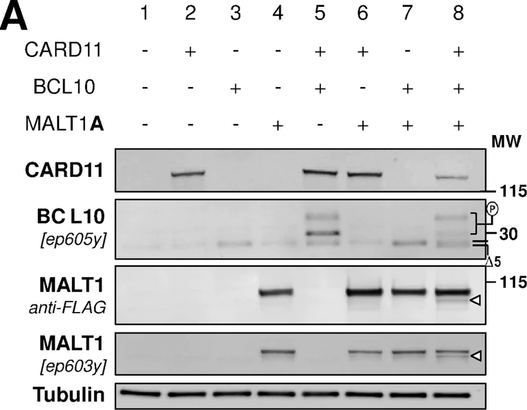 Western blot - Anti-MALT1/MLT antibody [EP603Y] (AB33921)