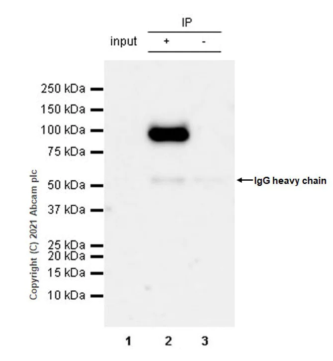 Immunoprecipitation - Anti-MALT1/MLT antibody [EP603Y] - BSA and Azide free (AB239823)