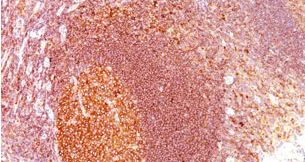Immunohistochemistry (Formalin/PFA-fixed paraffin-embedded sections) - Anti-MALT1/MLT antibody [MT1/410] (AB178581)