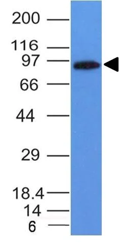 Western blot - Anti-MALT1/MLT antibody [MT1/410] (AB178581)
