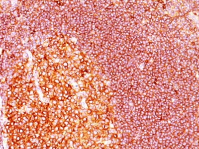 Immunohistochemistry (Formalin/PFA-fixed paraffin-embedded sections) - Anti-MALT1/MLT antibody [MT1/410] - BSA and Azide free (AB212285), expandable thumbnail