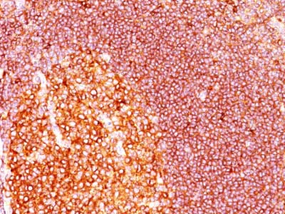 Immunohistochemistry (Formalin/PFA-fixed paraffin-embedded sections) - Anti-MALT1/MLT antibody [MT1/410] - BSA and Azide free (AB212285)
