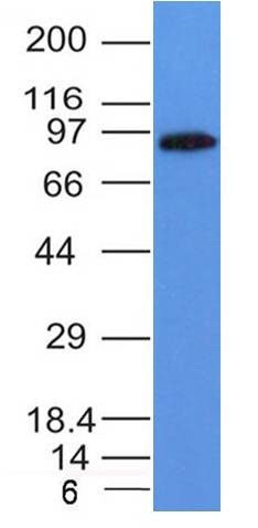 Western blot - Anti-MALT1/MLT antibody [MT1/410] - BSA and Azide free (AB212285), expandable thumbnail