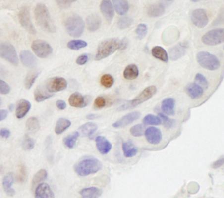 Immunohistochemistry (Formalin/PFA-fixed paraffin-embedded sections) - Anti-MAML2 antibody (AB245612)