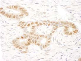 Immunohistochemistry (Formalin/PFA-fixed paraffin-embedded sections) - Anti-MAML2 antibody (AB90592)