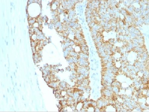 Immunohistochemistry (Formalin/PFA-fixed paraffin-embedded sections) - Anti-MAML2 antibody [MAML2/1302] (AB218338)