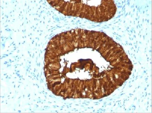 Immunohistochemistry (Formalin/PFA-fixed paraffin-embedded sections) - Anti-MAML3 antibody [MAML3/1303] (AB218492)