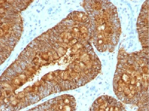 Immunohistochemistry (Formalin/PFA-fixed paraffin-embedded sections) - Anti-MAML3 antibody [MAML3/1303] (AB218492)