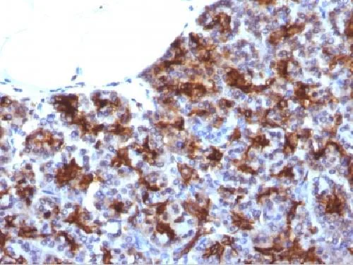 Immunohistochemistry (Formalin/PFA-fixed paraffin-embedded sections) - Anti-MAML3 antibody [MAML3/1303] (AB218492)