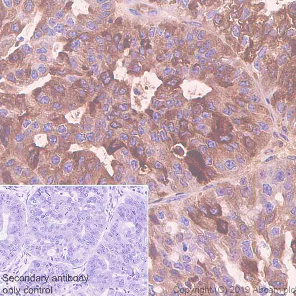 Immunohistochemistry (Formalin/PFA-fixed paraffin-embedded sections) - Anti-Mammaglobin A antibody [EPR9092] (AB150359)