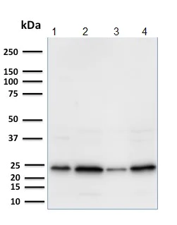 Western blot - Anti-Mammaglobin A antibody [MGB1/2000] (AB238018)