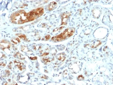 Immunohistochemistry (Formalin/PFA-fixed paraffin-embedded sections) - Anti-Mammaglobin A antibody [MGB1/2000] - BSA and Azide free (AB237862)